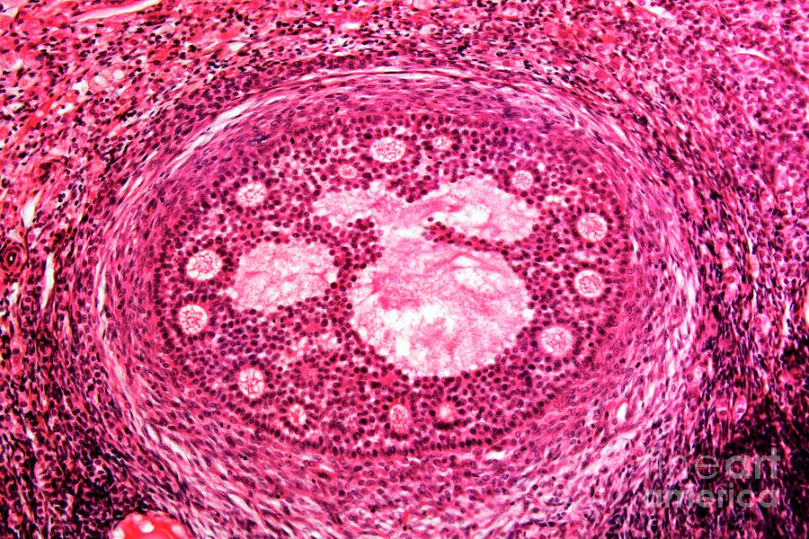 Ovarian Follicle Photograph by Dr Keith Wheeler/science Photo Library