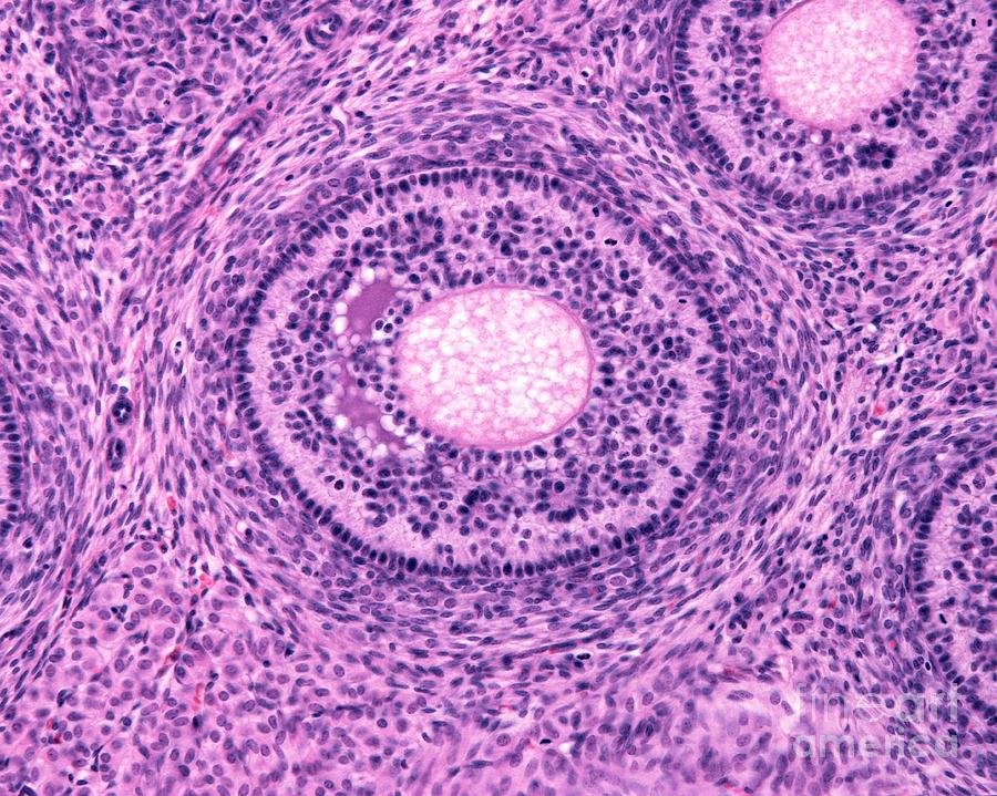Ovarian Follicle Photograph by Jose Calvo/science Photo Library - Fine ...
