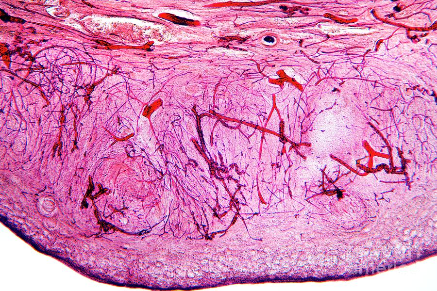 Ovary Tissue Photograph by Dr Keith Wheeler/science Photo Library