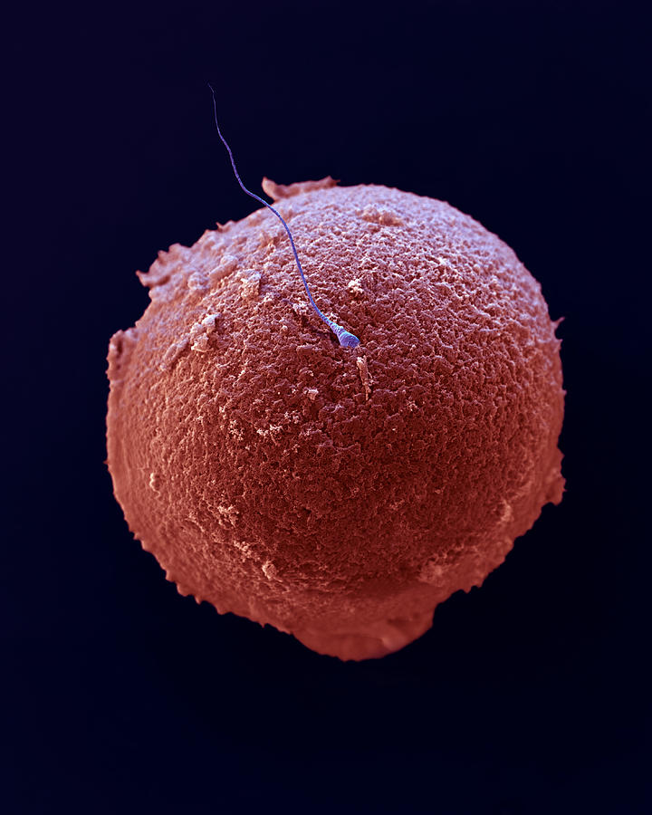 Ovum With Single Sperm Photograph by Meckes/ottawa