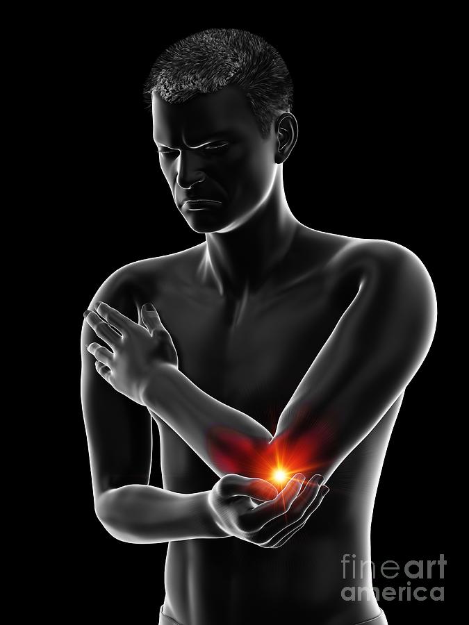 Painful Elbow Photograph by Sebastian Kaulitzki/science Photo Library