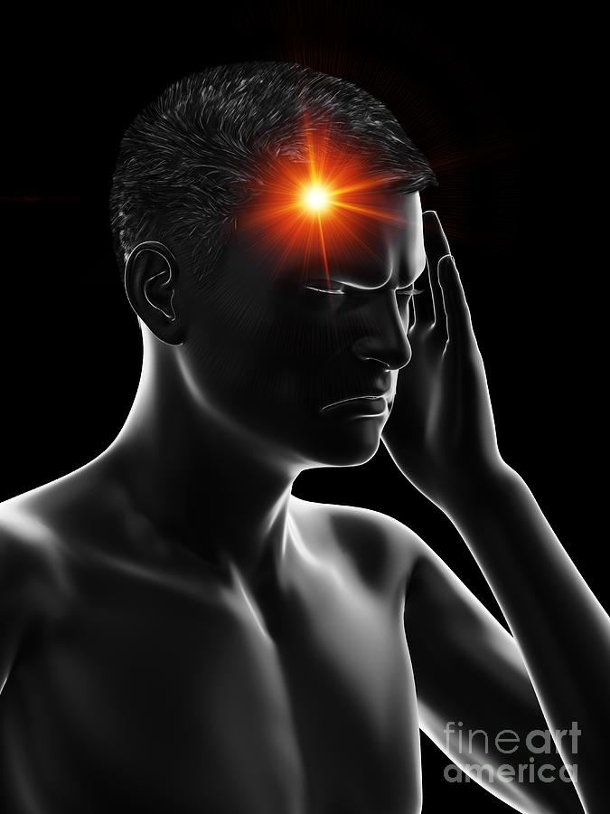 Painful Head Photograph by Sebastian Kaulitzki/science Photo Library
