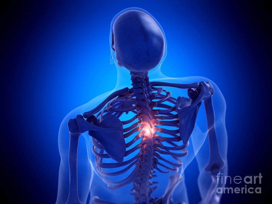 Painful Spine Photograph by Sebastian Kaulitzki/science Photo Library
