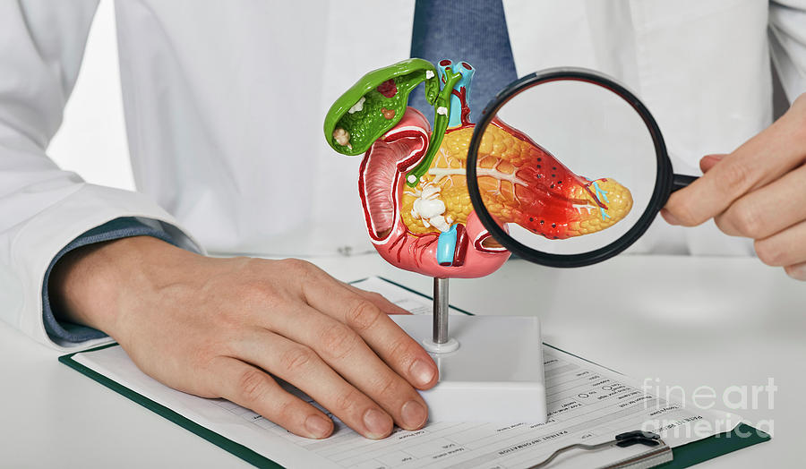 Pancreatic Disease Photograph by Peakstock / Science Photo Library