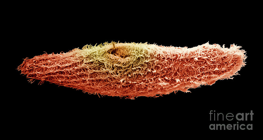 Red Photograph - Paramecium Bursaria Protozoa by Dr. Richard Kessel And Dr. Gene Shih / Science Photo Library