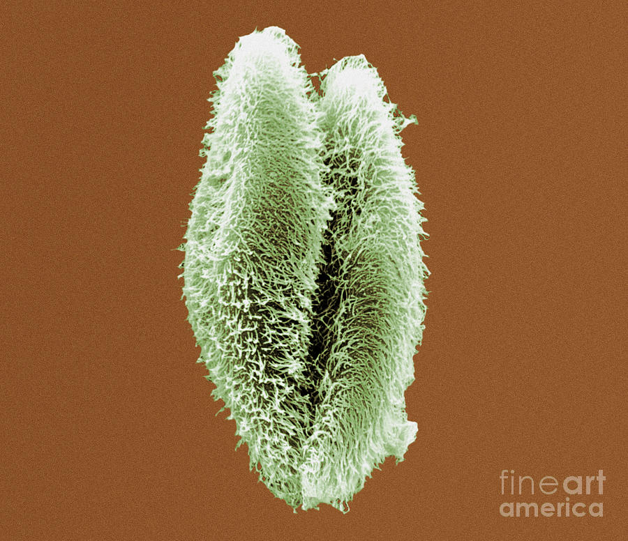 Protozoa Photograph - Paramecium Multimicronucleatum Protozoa by Dr. Richard Kessel And Dr. Gene Shih / Science Photo Library