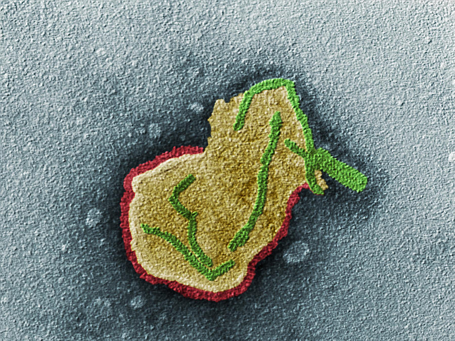 Paramyxovirus, Tem Photograph by Eye of Science