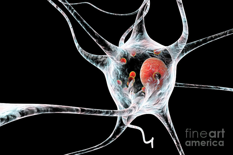Parkinsons Disease Nerve Cells Photograph by Kateryna Kon/science Photo Library