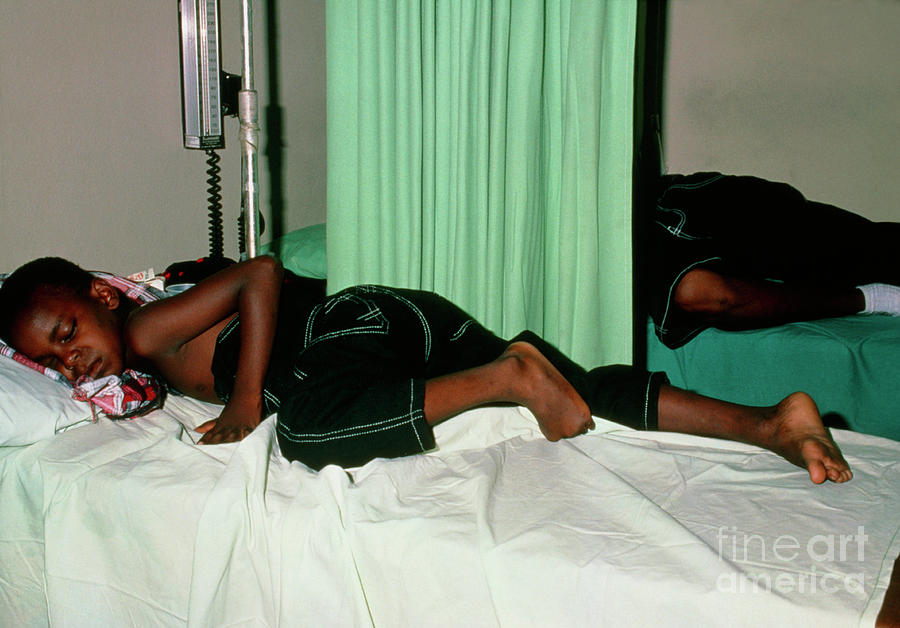 Patient With Sickle Cell Anaemia In Crisis Photograph by Sue Ford/science Photo Library