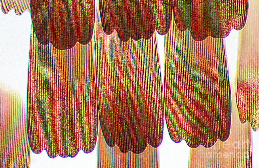 Peacock Butterfly Wing Scales Photograph by Dr Keith Wheeler/science Photo Library