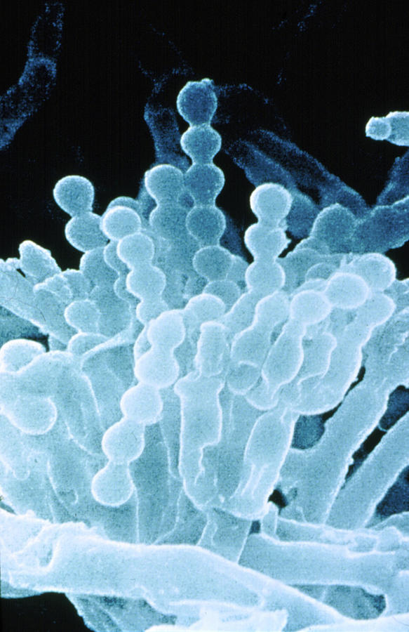 Penicillium Sp. Fungus, Sem Photograph by Johnny Carson
