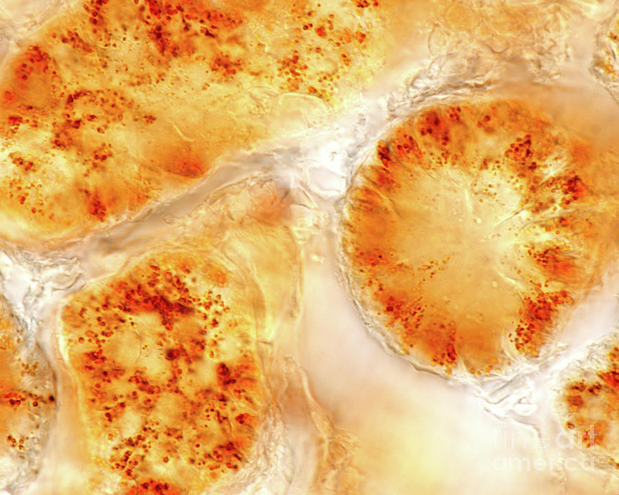 Peroxisomes In Kidney Convoluted Tubule Photograph by Jose Calvo / Science Photo Library
