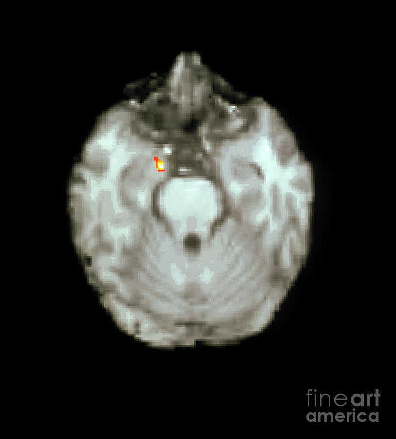 Pet Brain Scan Amygdala Response To Fear Photograph by Wellcome Centre Human Neuroimaging/science Photo Library