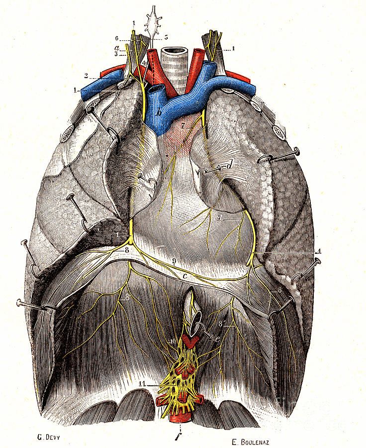 Phrenic Nerves Photograph by Collection Abecasis/science Photo Library ...