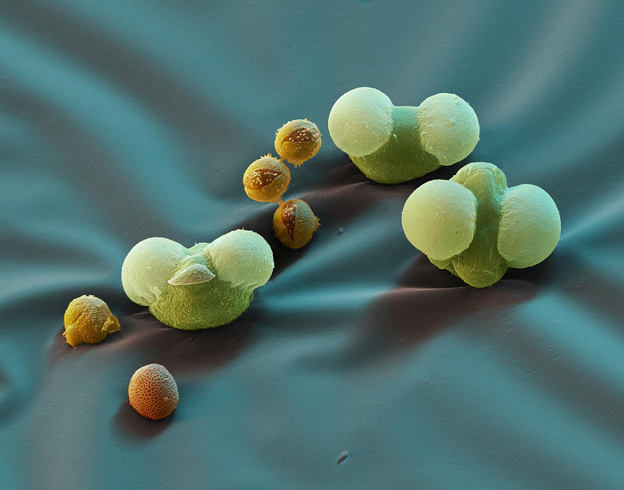 Pine, Chestnut, And Ash Pollen Grains Photograph by Meckes/ottawa