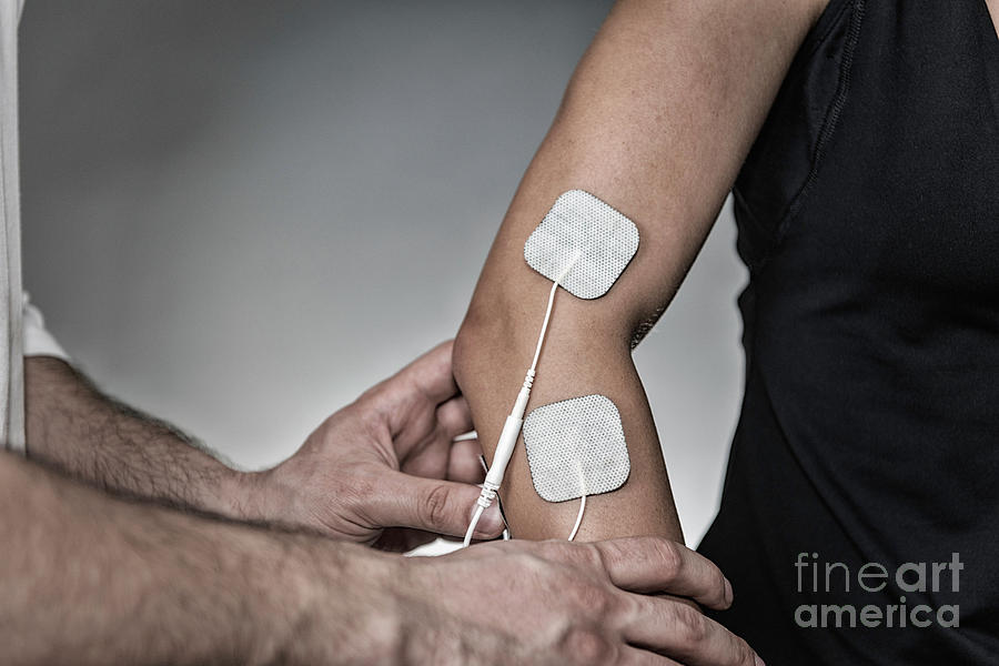 Elbow Photograph - Placing Tens Electrodes On Arm by Microgen Images/science Photo Library