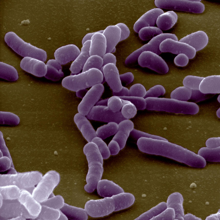 Plague Bacteria Photograph by Meckes/ottawa
