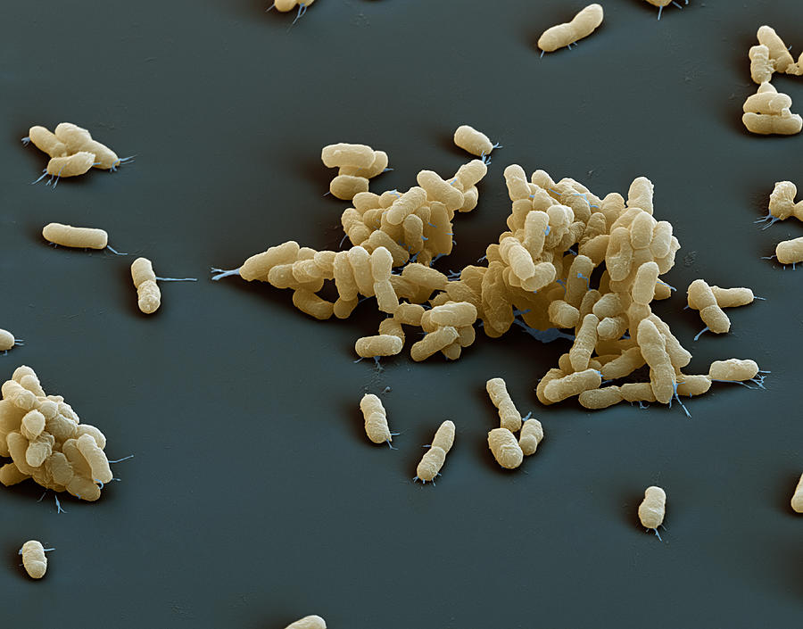 Plague Bacteria Yersinia Pestis, Sem Photograph by Meckes/ottawa