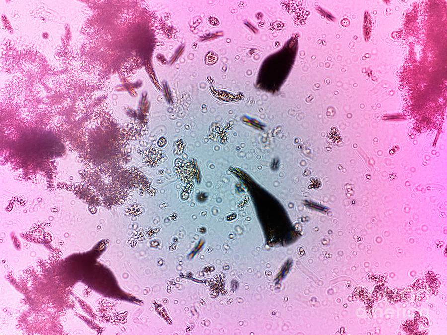 Plankton Under Ibm Autonomous Microscope Photograph by Ibm Research/science Photo Library