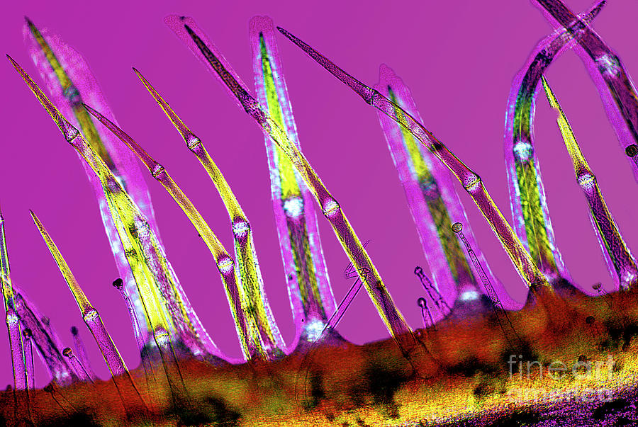 Stachys Sylvatica Photograph - Plant Stem Trichomes by Dr Keith Wheeler/science Photo Library Stachys Sylvatica Photograph - Plant Stem Trichomes by Dr Keith Wheeler/science Photo Library
