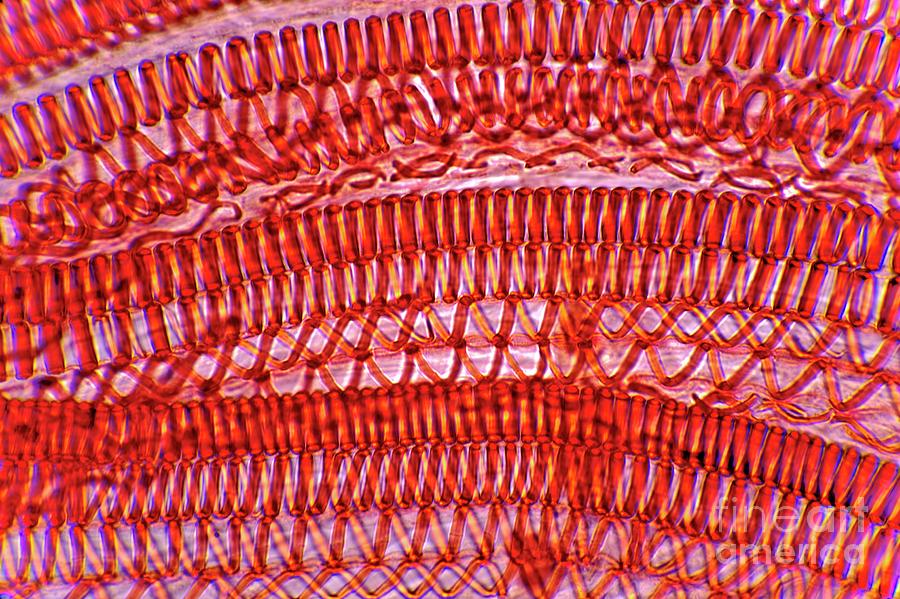 Plant Vascular Bundles Photograph by Dr Keith Wheeler/science Photo Library