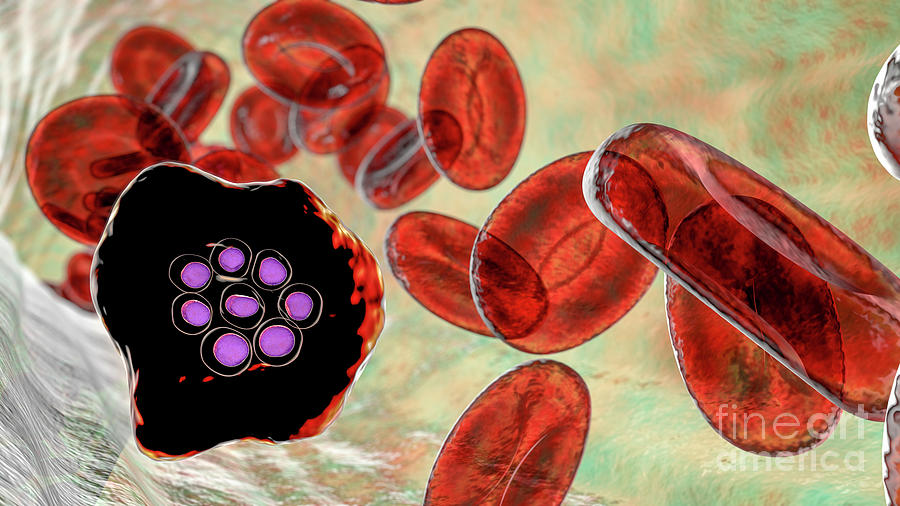 Plasmodium Ovale Inside Red Blood Cell Photograph by Kateryna Kon/science Photo Library