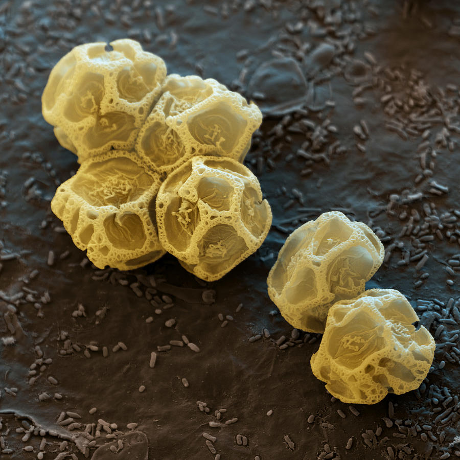 Plasmodium Spores Photograph by Meckes/ottawa