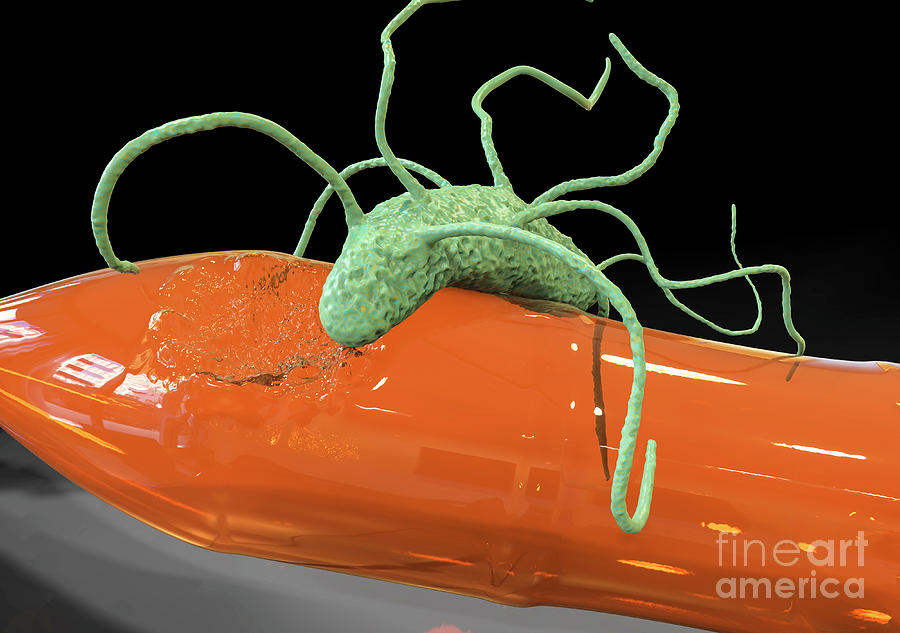 Plastic biodegradation: frontline microbes and their enzymes picture