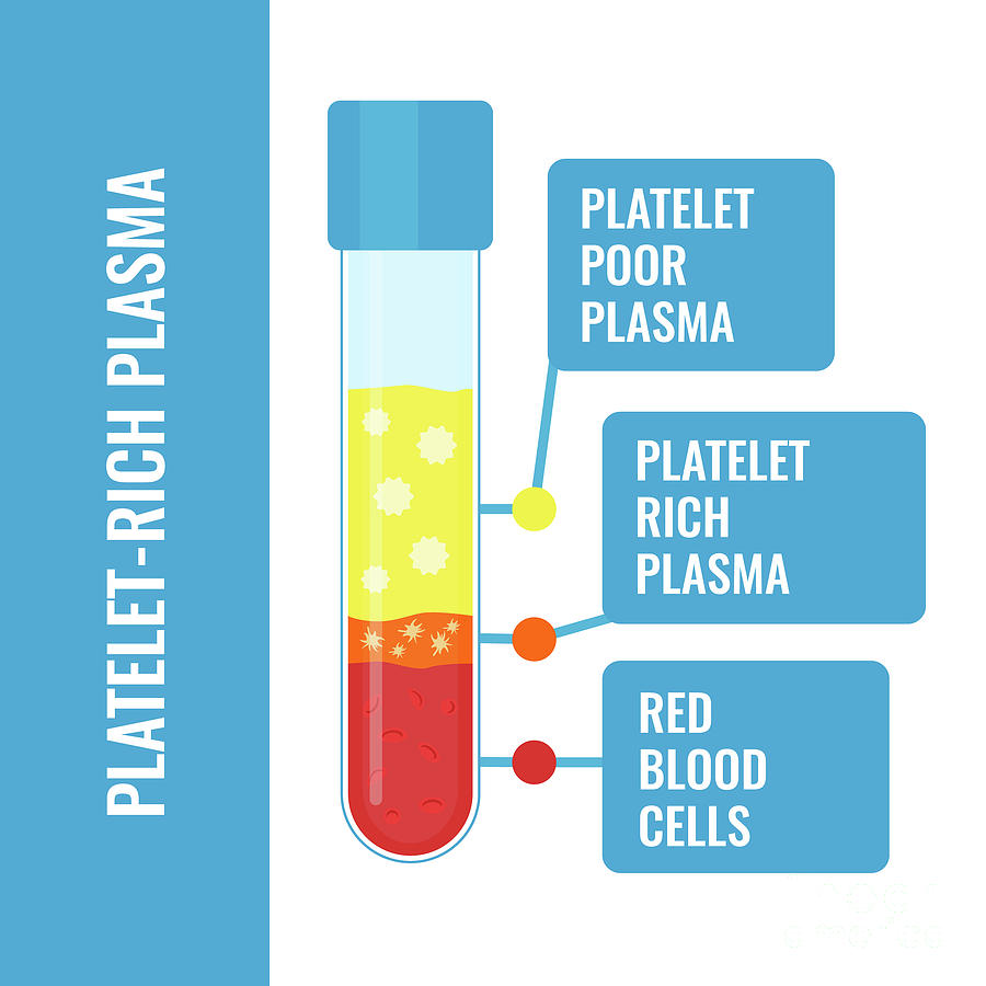 Sign Photograph - Platelet-rich Plasma Composition by Art4stock/science Photo Library