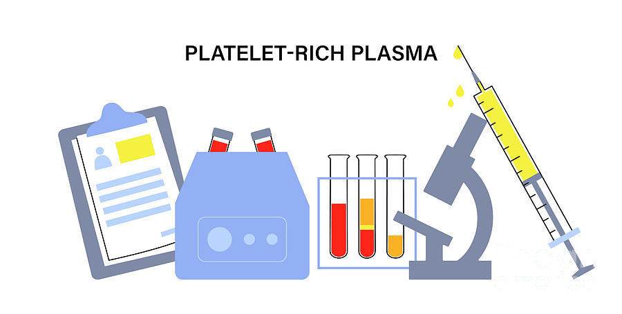 Prp Photograph - Platelet Rich Plasma Therapy by Pikovit / Science Photo Library