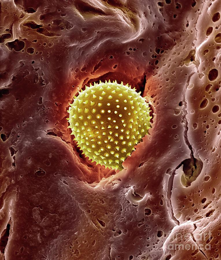 Pollen Trapped In Mucus On Nose Hair Photograph by Dennis Kunkel Microscopy/science Photo Library
