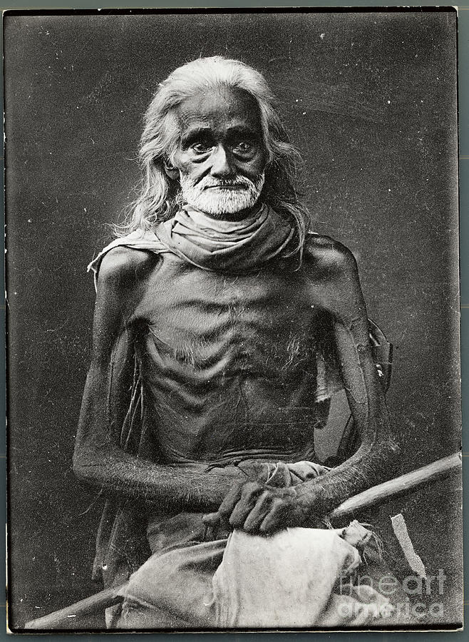 Portrait Of Emaciated Man Photograph by Bettmann