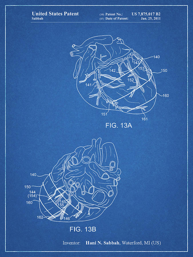 Heart Digital Art - Pp702-blueprint Anatomical Heart Poster by Cole Borders