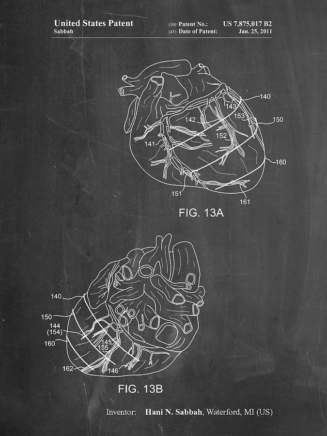 Heart Digital Art - Pp702-chalkboard Anatomical Heart Poster by Cole Borders