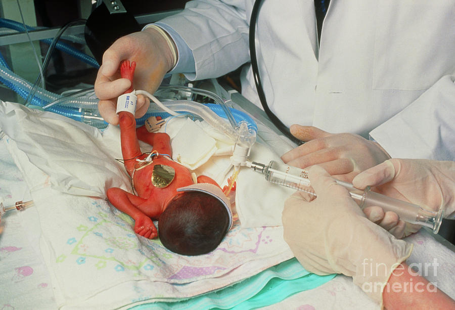 Premature Baby Receiving Pfc Liquid Into Its Lungs Photograph by John Greim/science Photo Library
