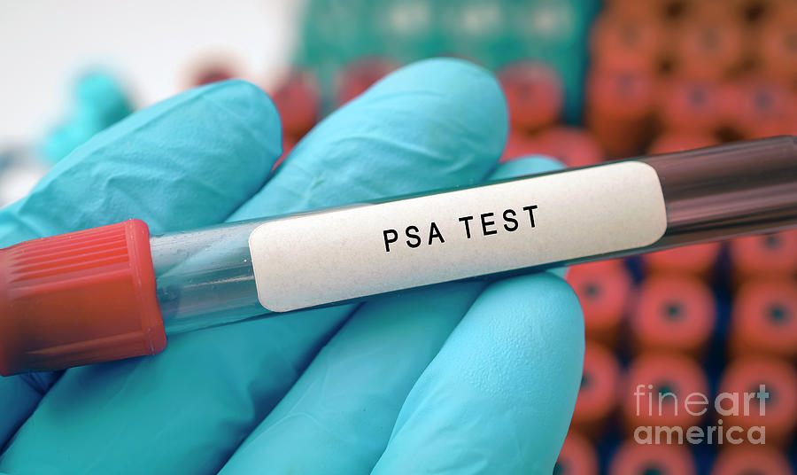 Prostate-specific Antigen Test Photograph by Wladimir Bulgar/science ...