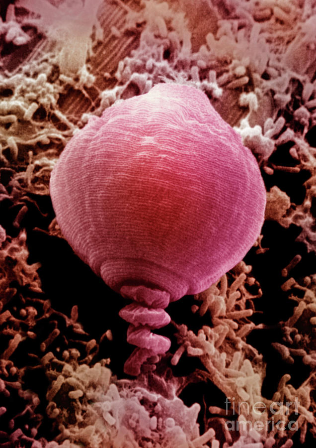 Protozoan Vorticella. Sem Photograph by Dr. Richard Kessel And Dr. Gene Shih / Science Photo Library