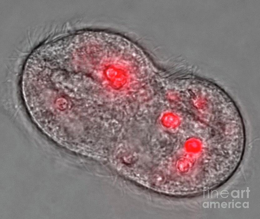 Protozoan With Ingested Quantum Dots Photograph by National Institute Of Standards And Technology/science Photo Library