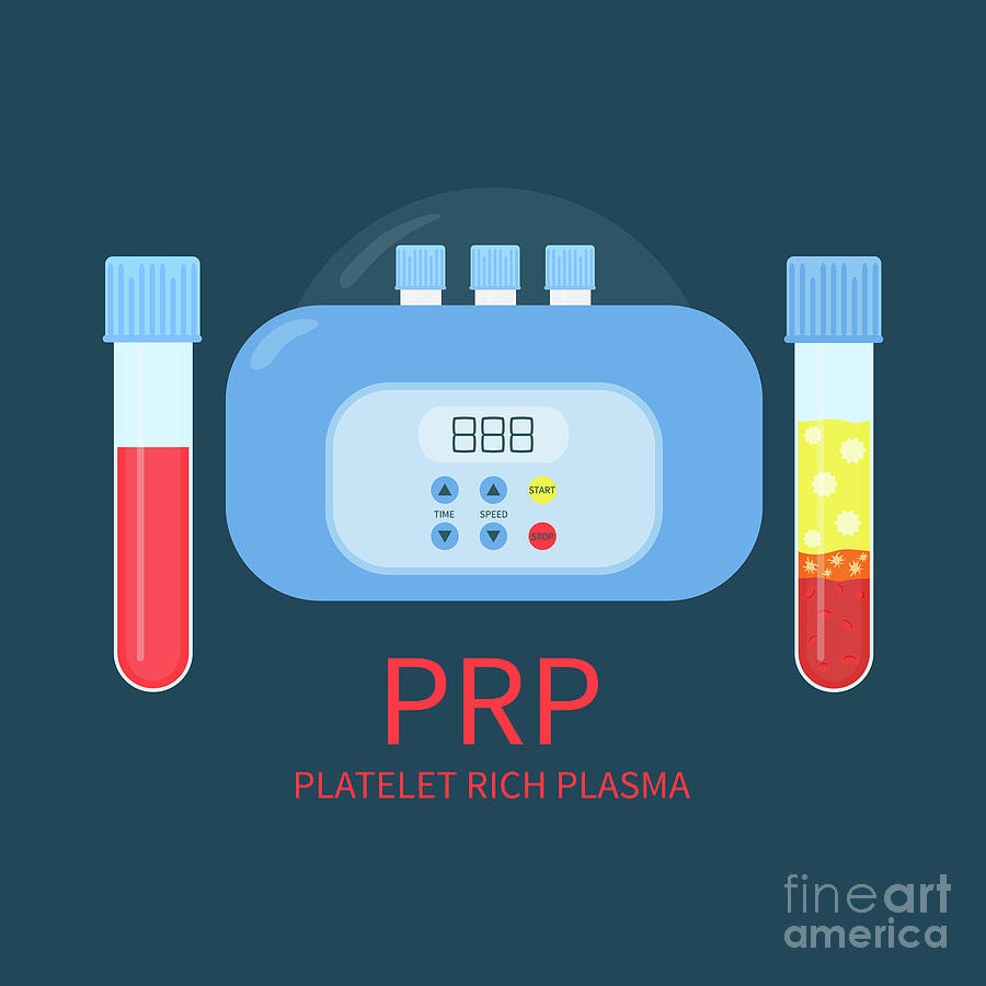Sign Photograph - Prp Laboratory Equipment Kit by Art4stock/science Photo Library