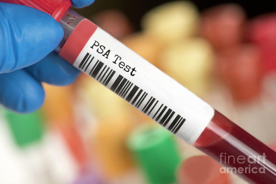 Psa Blood Test Tube Photograph by Sherry Yates Young/science Photo ...