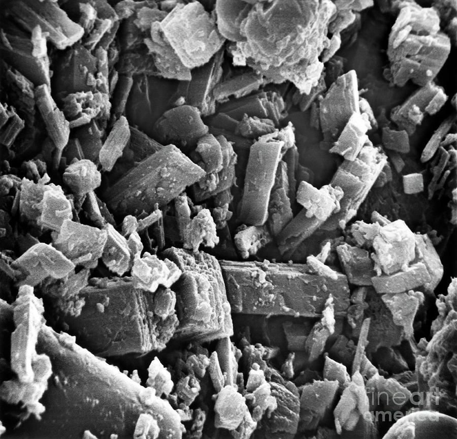 Pseudogout Showing Calcium Phosphate Crystals Photograph by Dr Gilbert Faure/science Photo Library