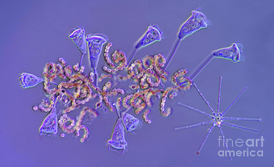 Pseudovorticella And Cyanobacteria Photograph by Marek Mis/science Photo Library