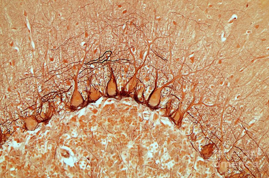 Purkinje Nerve Cells by Steve Gschmeissner/science Photo Library