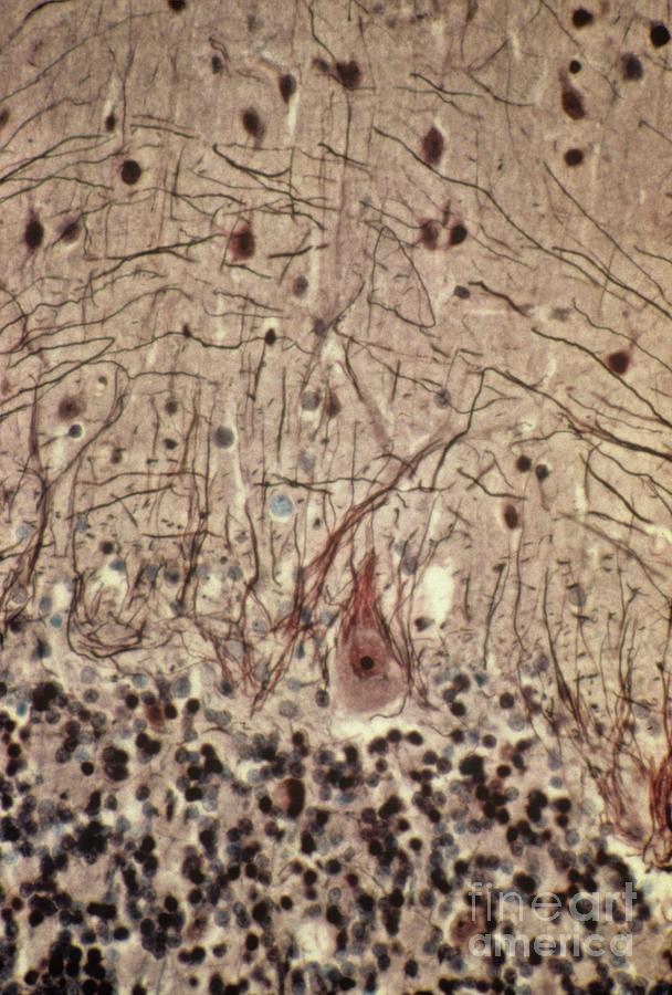 Purkinje Nerves Cells Photograph by Prof. J.j. Hauw/science Photo Library