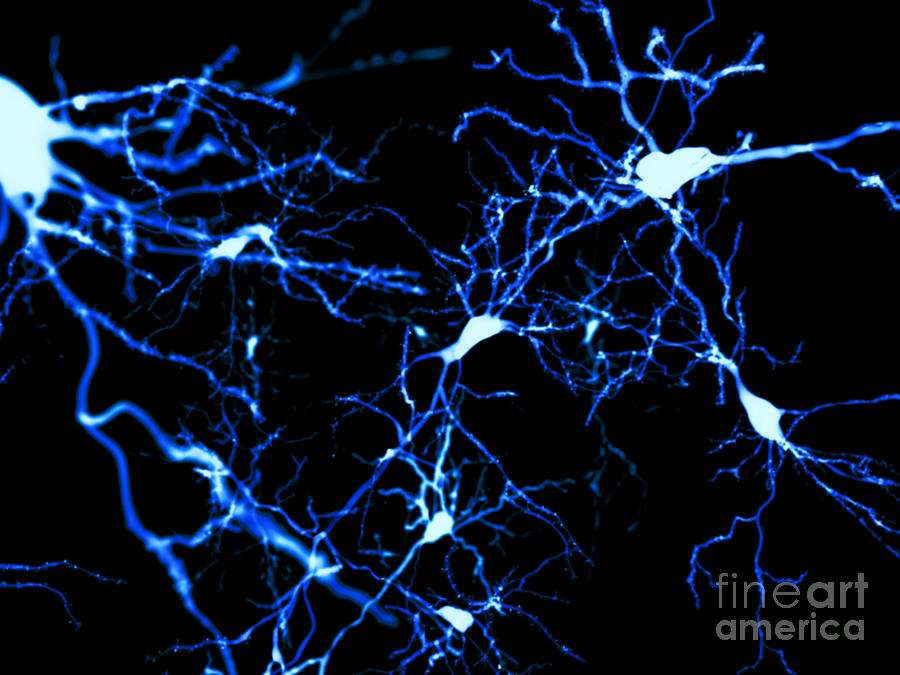 Pyramidal Neurons Photograph by Juan Gaertner/science Photo Library