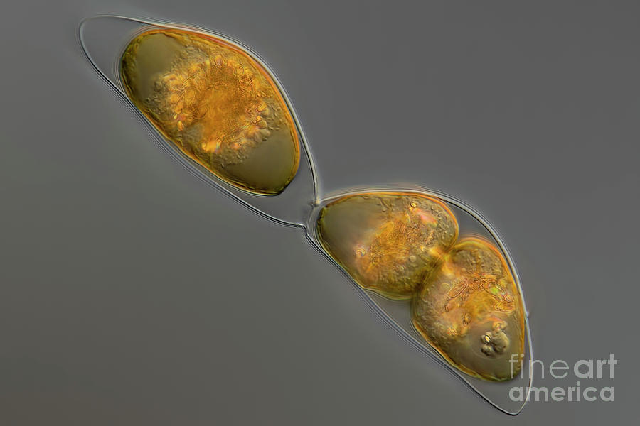 Pyrocystis Sp. Cf. Algae Photograph by Frank Fox/science Photo Library