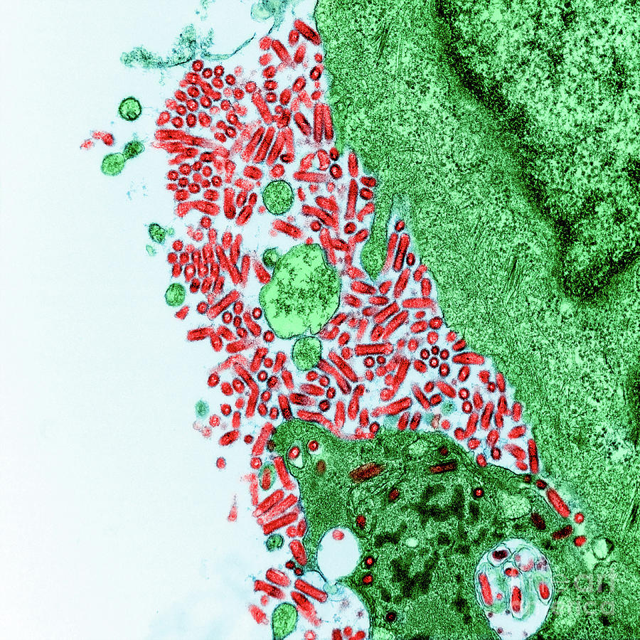 Rabies Virus Photograph by Niaid/national Institutes Of Health/science ...