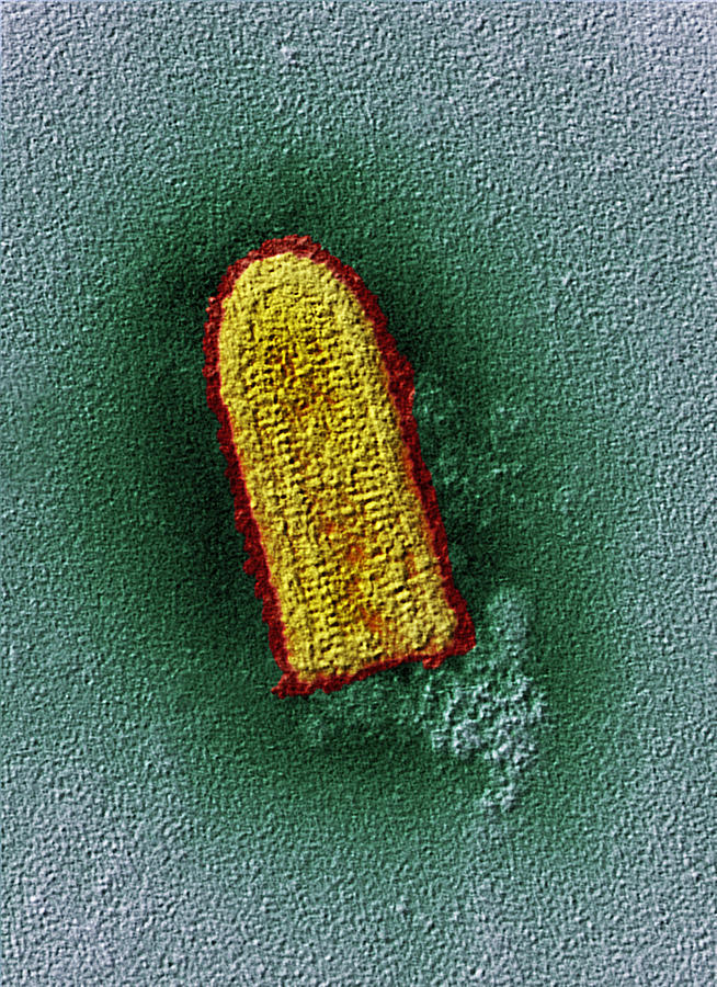 Rabies Virus, Tem Photograph by Oliver Meckes EYE OF SCIENCE