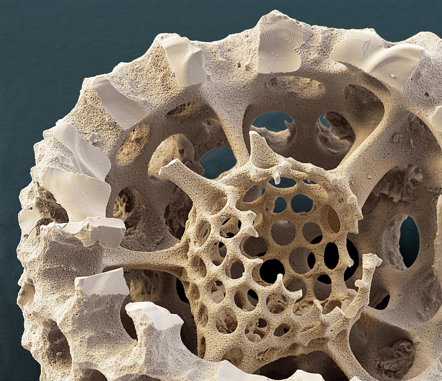 Radiolarian Stylosphæra Sp., Sem Photograph by Oliver Meckes EYE OF SCIENCE