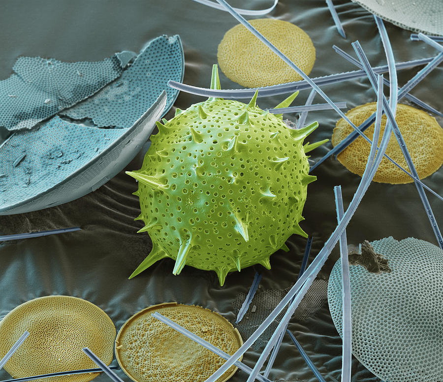 Radiolarians And Diatoms, Sem Photograph by Oliver Meckes EYE OF SCIENCE